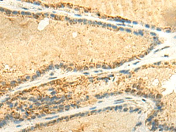 METTL10 Antibody