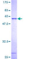 Human THG1L Protein (Recombinant GST)