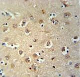 MEIS2 Antibody (aa254-280)