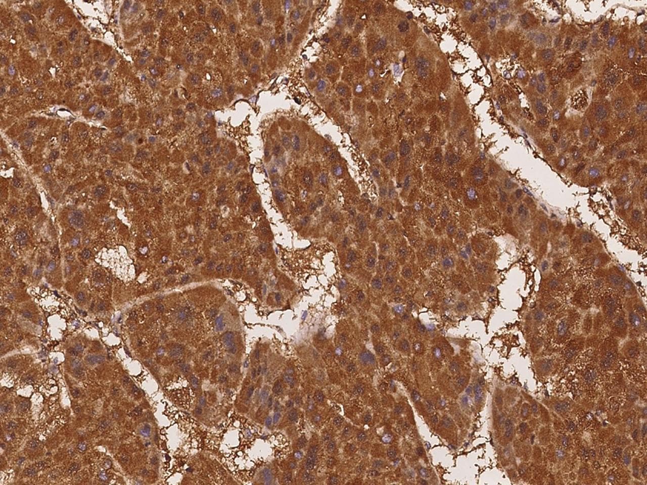 TNXB / Tenascin XB Antibody (Preservative Free)