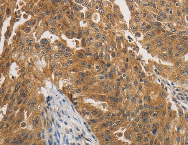 PTPN11 / SHP-2 / NS1 Antibody