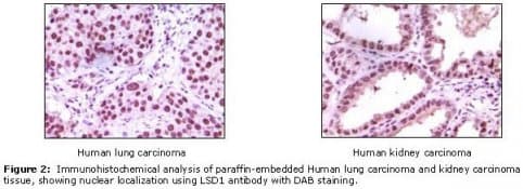 Monoclonal Mouse anti-Human KDM1A / LSD1 Antibody (clone 1B2E5, IHC, WB)