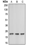 CBLN2 / Cerebellin 2 Antibody (C-Terminus)