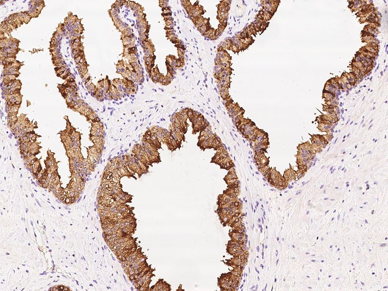 MSMB / MSP Antibody (Preservative Free)