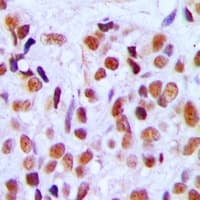 Polyclonal Rabbit anti-Human RRP8 Antibody (Internal, IHC, WB)
