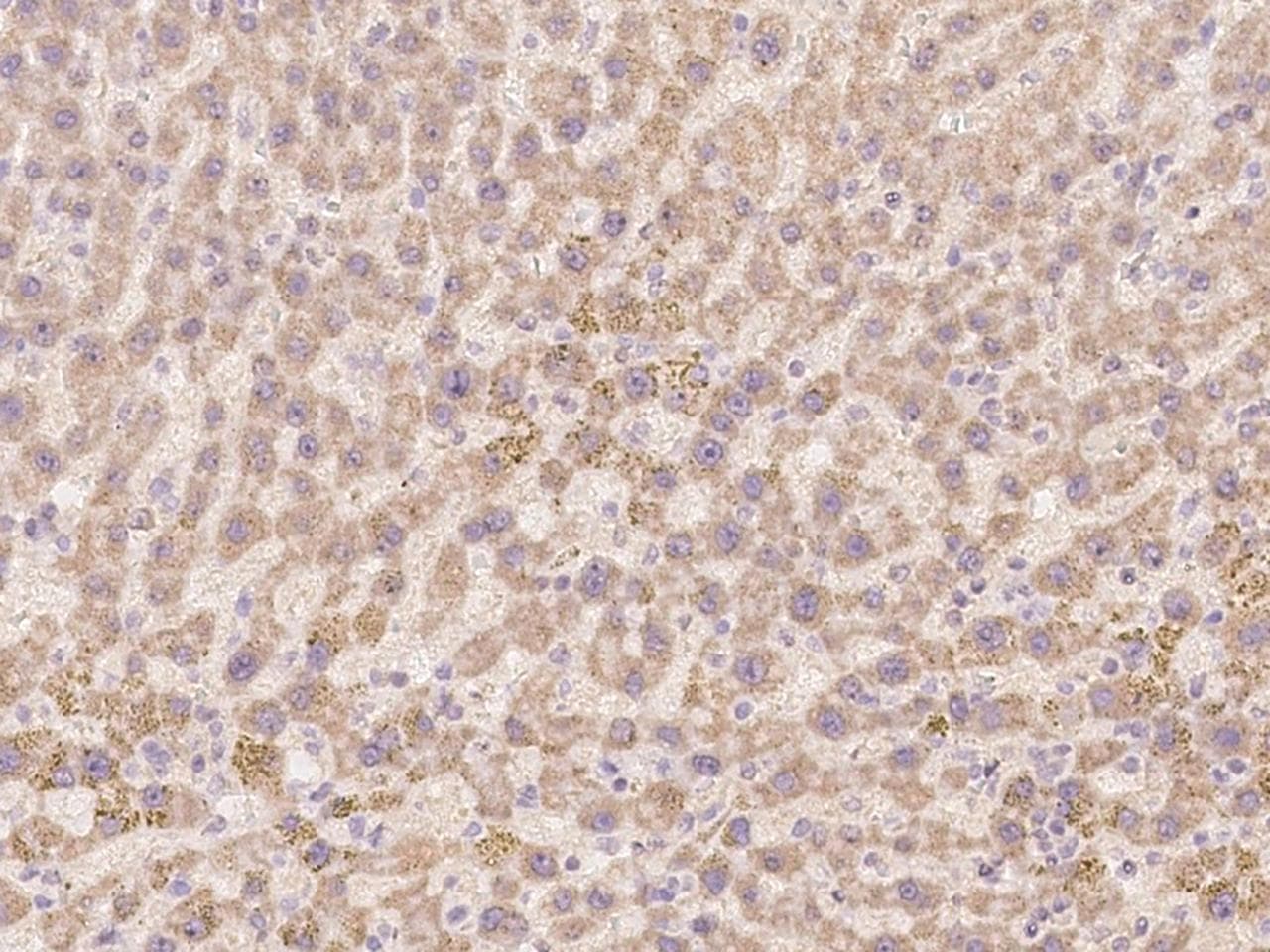 TLX2 / NCX Antibody