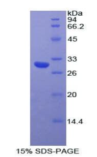 Human MYO1A Protein (Recombinant His)