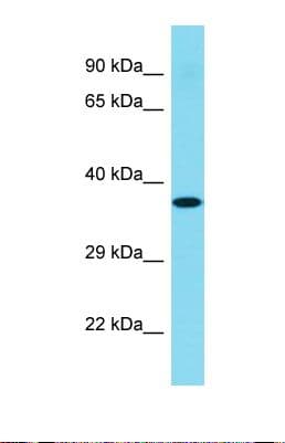 Polyclonal Rabbit anti-Human C1orf168 Antibody (aa29-78, WB)