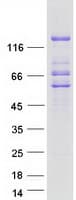 Human LPIN2 / Lipin 2 Protein (Recombinant Myc-DDK (Flag))