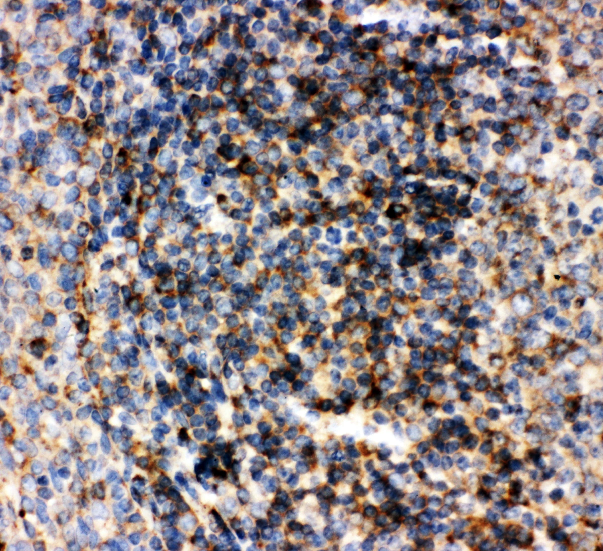 CD22 Antibody (aa832-847)