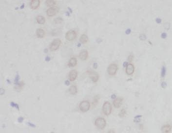 Polyclonal Rabbit anti-Human PCDH10 Antibody (IHC, IF, WB)