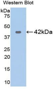 KRT5 / CK5 / Cytokeratin 5 Antibody (aa166-474)