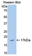 COMP / THBS5 Antibody (aa35-179)