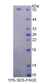 Human NSMAF Protein (Recombinant His-GST)