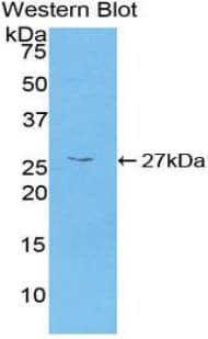 Polyclonal Rabbit anti-Human CAMK2G / CaMK II Gamma Antibody (aa6-208, WB)