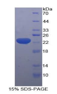 Human HMGCS1 / HMG-CoA Synthase 1 Protein (Recombinant His-T7)
