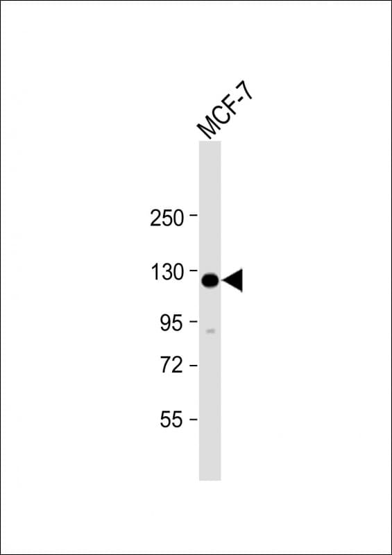 HEATR6 / ABC1 Antibody (N-Terminus)