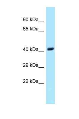 UBE2Q1 Antibody (aa174-223)