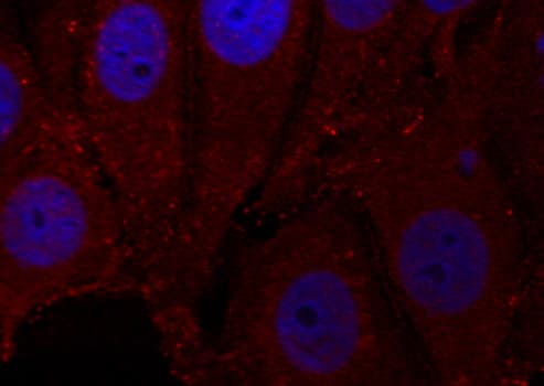 SNCA / Alpha-Synuclein Antibody (phospho-Tyr133)