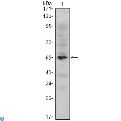 MUM1 Antibody
