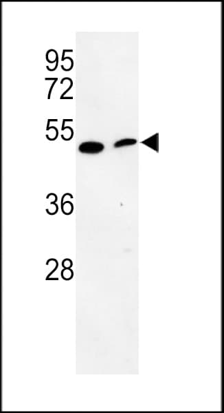 DJ858B16.2 / PISD Antibody (aa223-250)