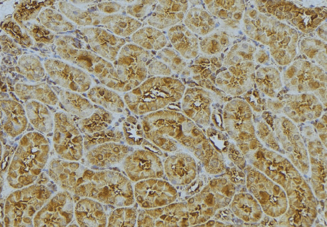 CAPZA1 / CAPZ Alpha 1 Antibody