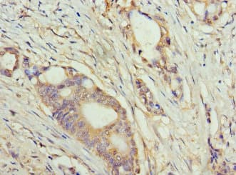 Polyclonal Rabbit anti-Human LCX / TET1 Antibody (aa1700-1800, IHC)