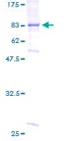 Human BBS4 Protein (Recombinant GST)
