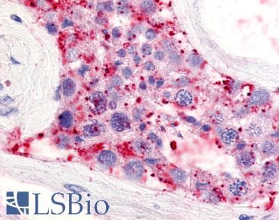 IHC-plus™ Polyclonal Rabbit anti-Human LPAR5 / GPR92 Antibody (Extracellular Domain, IHC)