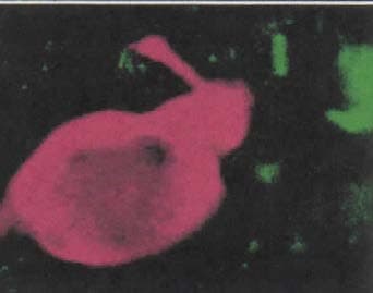 GNRH Antibody (clone LHRH13-327.8)