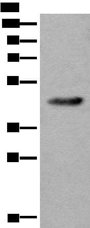 Polyclonal Rabbit anti-Human CDKL4 Antibody (IHC, WB)