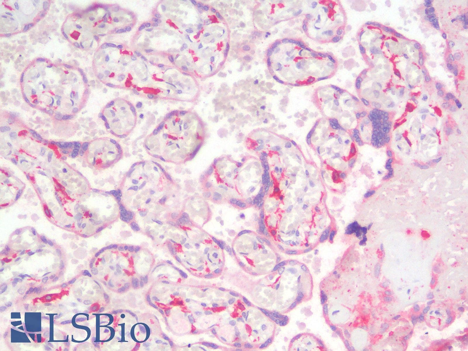 PathPlus™ Polyclonal Rabbit anti-Human CD163 Antibody (IHC)