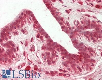 IHC-plus™ Polyclonal Rabbit anti-Human SRPK1 Antibody (IHC, WB)