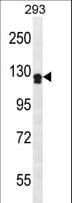 Polyclonal Rabbit anti-Human UNC5D Antibody (aa483-511, WB)