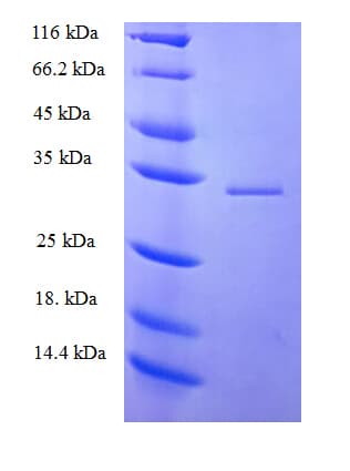 Human PRKRIR Protein (Recombinant His-SUMO)