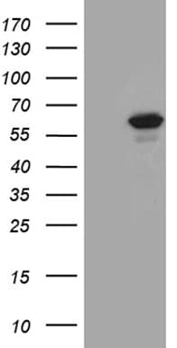 PPP2R1B Antibody (aa19-601, clone OTI8B6)