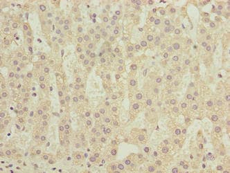COMMD2 Antibody