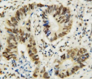 Polyclonal Rabbit anti-Human MTA1 Antibody (aa676-696, IHC, WB)