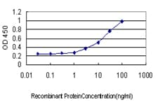 IHC-plus™ Monoclonal Mouse anti-Human KDM1A / LSD1 Antibody (clone 2E7, IHC, IF, WB)