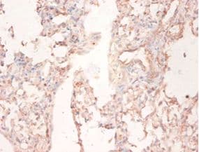 FASN / Fatty Acid Synthase Antibody (aa2155-2495)