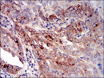 IGFBP7 / TAF Antibody (aa52-156, clone 1D9E7)