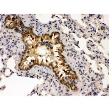 GRK5 Antibody (aa393-429)