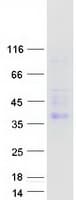 Human CEACAM4 Protein (Recombinant Myc-DDK (Flag))