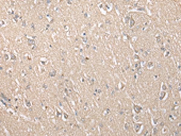 ECI1 / DCI Antibody