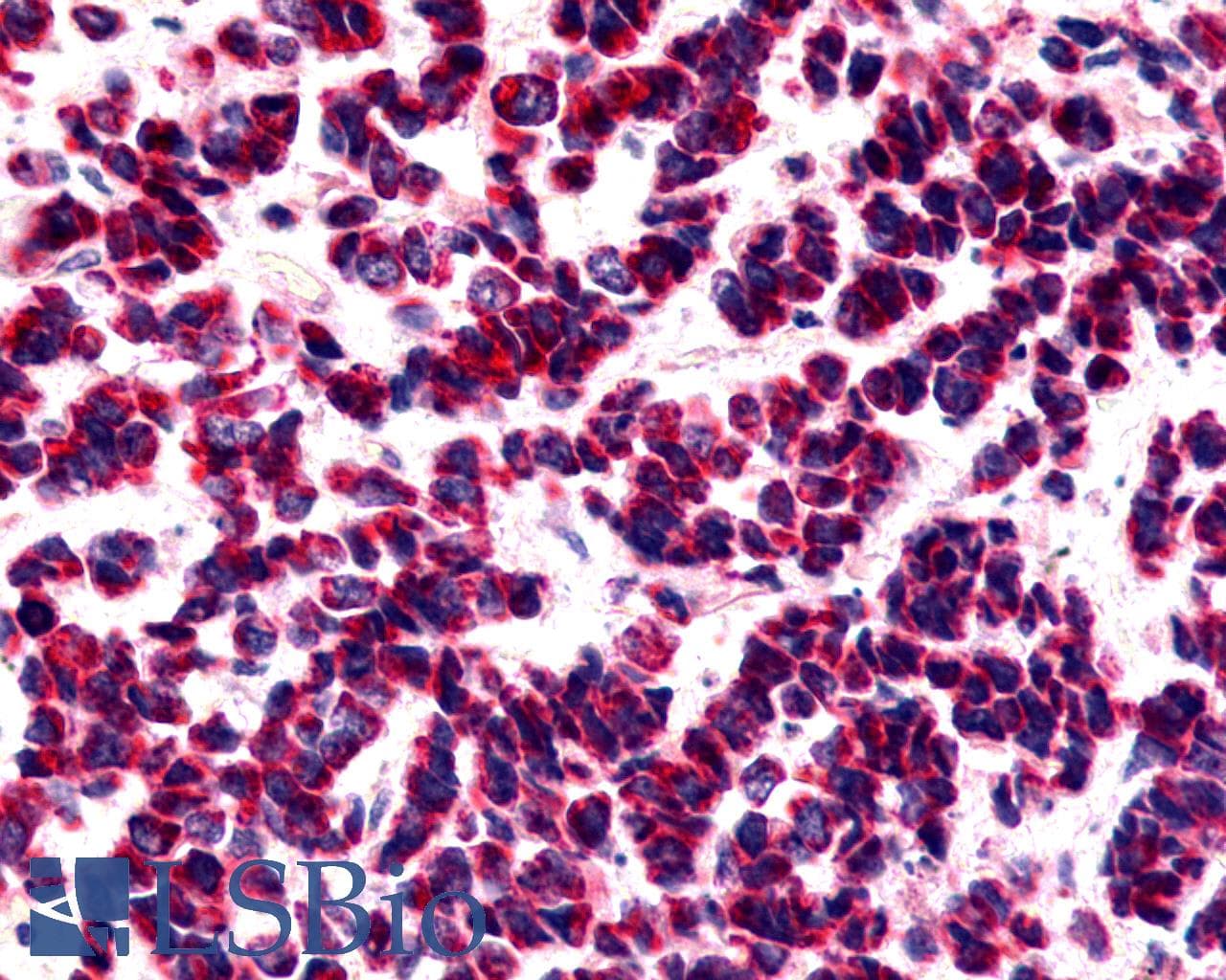 PathPlus™ BOB / GPR15 Antibody (Cytoplasmic Domain)