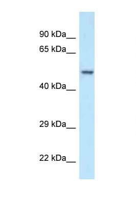 Polyclonal Rabbit anti-Human POLG2 Antibody (aa45-94, WB)