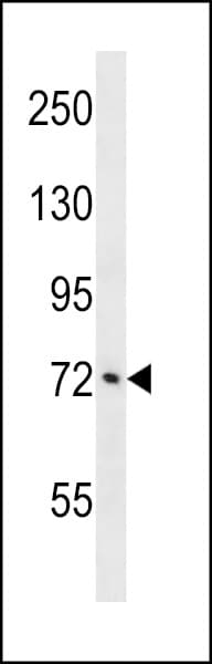 ATXN1L Antibody (aa385-411)