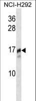 TRAPPC2 / SEDL Antibody (aa11-39)