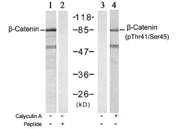 CTNNB1 / Beta Catenin Antibody (phospho-Thr41/Ser45)