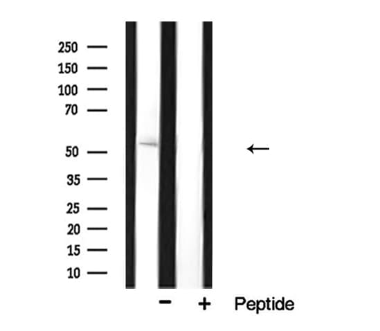 Polyclonal Rabbit anti-Human CYP17 / CYP17A1 Antibody (IHC, IF, WB)